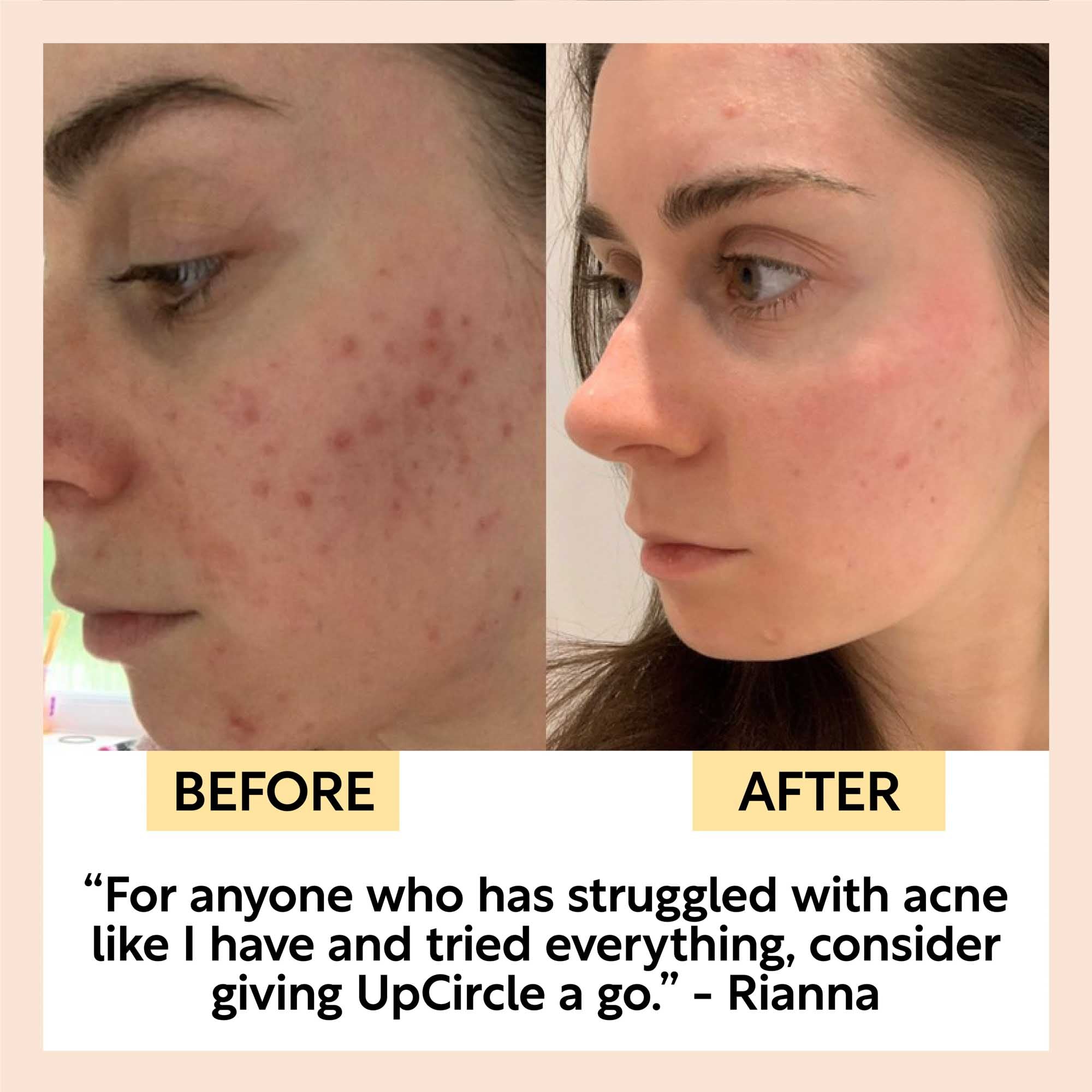 Face Toner with Hyaluronic Acid